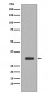 Anti-PIM1 Rabbit Monoclonal Antibody